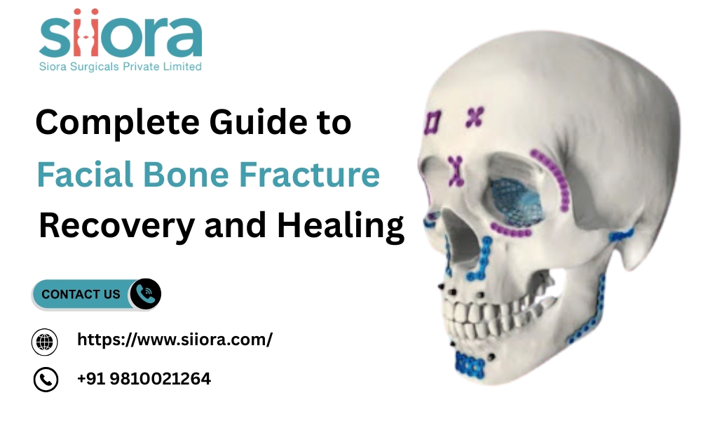 Facial Bone Fracture